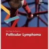 Fast Facts for Patients: Follicular Lymphoma (PDF)