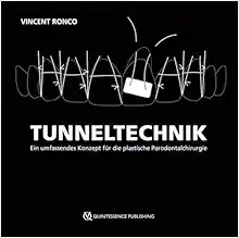 Tunneltechnik (PDF)