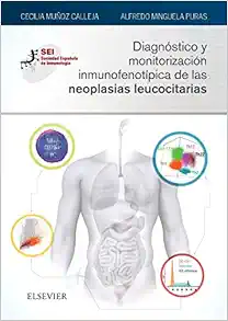 Diagnóstico y monitorización inmunofenotípica de las neoplasias leucocitarias: Sociedad Española de Inmunología (PDF)