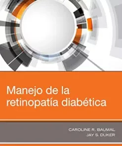 Manejo de la retinopatía diabética (Spanish Edition) (PDF)