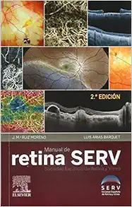 Manual de retina SERV, 2nd Edition (PDF)