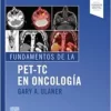 Fundamentos de la PET-TC en oncología (PDF)