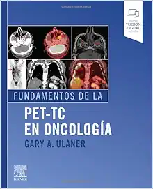 Fundamentos de la PET-TC en oncología (PDF)