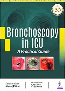 Bronchoscopy in ICU: A Practical Guide (PDF)