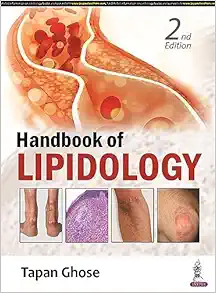 Handbook of Lipidology, 2nd Edition (PDF)