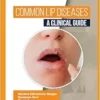 Common Lip Diseases: A Clinical Guide (PDF)