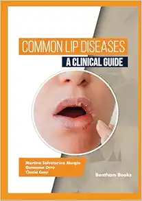 Common Lip Diseases: A Clinical Guide (EPUB)