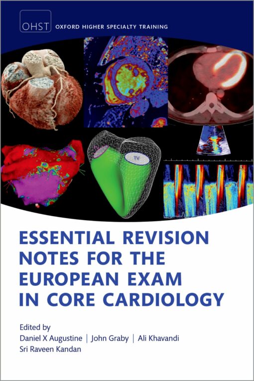 Essential Revision notes for the European Exam in Core Cardiology, 2nd Edition (EPUB)