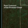 Rare Tumours of the Prostate Gland (PDF)