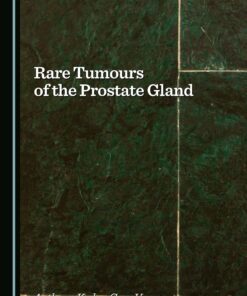 Rare Tumours of the Prostate Gland (PDF)