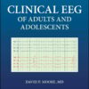 Clinical EEG of Adults and Adolescents (PDF)
