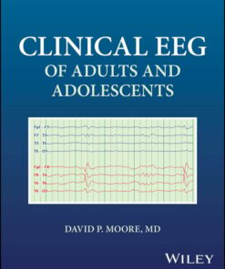 Clinical EEG of Adults and Adolescents (PDF)