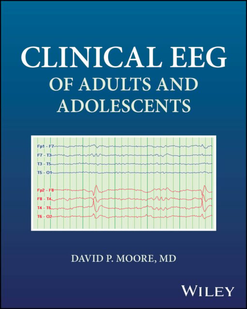 Clinical EEG of Adults and Adolescents (EPUB)