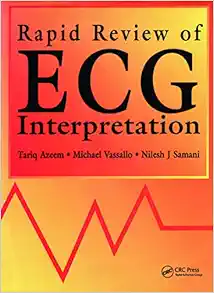 Rapid Review of ECG Interpretation (Medical Rapid Review Series) (PDF)