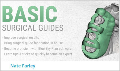 DigitalDDS Basic Surgical Guides By Nate Farley